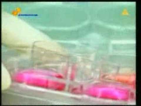 Glucosion - Pomożemy Ci Wyeliminować Ból Stawów